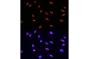 Immunofluorescence analysis of HeLa cells using MITF Rabbit mAb (ABIN7268511) at dilution of 1:100 (40x lens). (MITF 抗体)