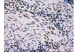 Immunohistochemical staining of paraffin-embedded pancreas tissue using anti-MRI1mouse monoclonal antibody. (MRI1 抗体)