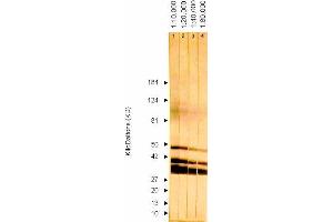 Western Blotting (WB) image for anti-ICP36 DNA Binding Protein (CMV ICP36) antibody (ABIN265543) (ICP36 DNA Binding Protein (CMV ICP36) 抗体)