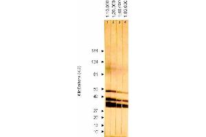 Western Blotting (WB) image for anti-ICP36 DNA Binding Protein (CMV ICP36) antibody (ABIN265542) (ICP36 DNA Binding Protein (CMV ICP36) 抗体)