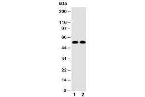 Western blot testing of Alpha Amylase 1 antibody and Lane 1:  rat liver (Alpha-amylase 1 抗体  (N-Term))