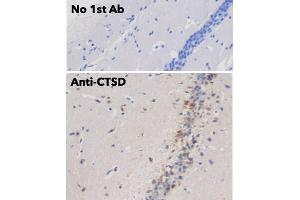 Immunohistochemistry (IHC) image for anti-Cathepsin D (CTSD) (C-Term) antibody (ABIN6254162)