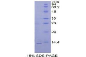 SDS-PAGE analysis of Prokineticin 2 Protein. (PROK2 蛋白)