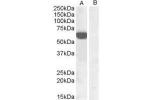 HEK293 overexpressing human IRF5 and probed with ABIN184812 at 1ug/ml (mock transfection in lane B). (IRF5 抗体  (C-Term))