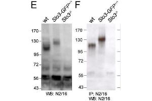 Immunoblot versus (E) membrane proteins from wild- type (wt), Slo3-eGFP and Slo3 knockout (Slo3-/-) mouse testes and (F) immunoprecipitation products from total testes proteins pulled down with N2/16 probed with N2/16.