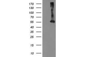 Western Blotting (WB) image for anti-Makorin Ring Finger Protein 1 (MKRN1) antibody (ABIN1499487) (MKRN1 抗体)