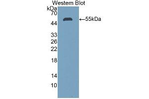 Detection of Recombinant STC1, Human using Polyclonal Antibody to Stanniocalcin 1 (STC1) (Stanniocalcin 1 抗体  (AA 28-247))