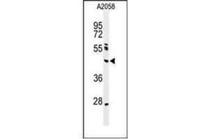 Western blot analysis of NEIL1 Antibody (Center) in A2058 cell line lysates (35ug/lane). (NEIL1 抗体  (Middle Region))