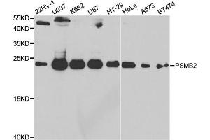 Western blot analysis of extracts of various cell lines, using PSMB2 antibody (ABIN5973193) at 1/1000 dilution. (PSMB2 抗体)