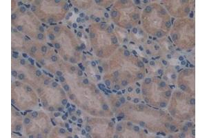 Immunohistochemistry (IHC) image for anti-serpin Peptidase Inhibitor, Clade A (Alpha-1 Antiproteinase, Antitrypsin), Member 10 (SERPINA10) (AA 22-448) antibody (ABIN7434530)