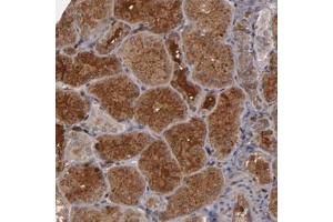 Immunohistochemical staining of human kidney with SERPINA7 polyclonal antibody  shows cytoplasmic and extracellular positivity in cells of tubules. (SERPINA7 抗体)