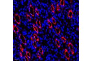 Immunofluorescence (Paraffin-embedded Sections) (IF (p)) image for anti-Mal, T Cell Differentiation Protein 2 (MAL2) antibody (ABIN7074549)