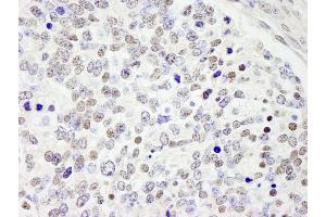 Immunohistochemistry (IHC) image for anti-Cell Division Cycle 25 Homolog C (S. Pombe) (CDC25C) (AA 150-200) antibody (ABIN7448466)
