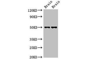 Western Blot Positive WB detected in: Mouse brain tissue, Rat brain tissue All lanes: Gfap antibody at 2. (GFAP 抗体  (AA 1-430))