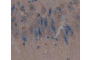 IHC-P analysis of Kidney tissue, with DAB staining. (IDS 抗体  (AA 107-363))