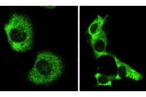 Image no. 2 for anti-Autophagy/beclin-1 Regulator 1 (AMBRA1) (N-Term) antibody (ABIN347117) (AMBRA1 抗体  (N-Term))