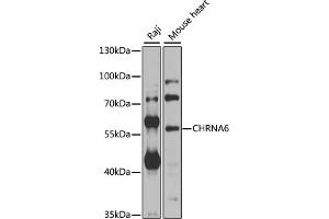 Western blot analysis of extracts of various cell lines, using CHRN antibody  at 1:1000 dilution. (CHRNA6 抗体  (AA 350-440))