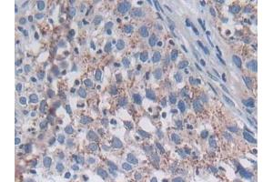 Immunohistochemistry (IHC) image for anti-Sorting Nexin 13 (SNX13) (AA 97-284) antibody (ABIN7434740)