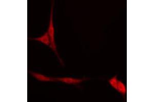 ABIN6274553 staining Hela cells by IF/ICC. (ATF5 抗体  (N-Term))
