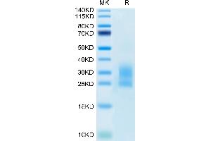 SDS-PAGE (SDS) image for Killer Cell Lectin-Like Receptor Subfamily K, Member 1 (KLRK1) (AA 90-232) protein (His tag) (ABIN7275344)