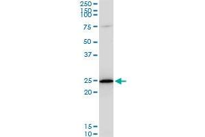 TPT1 monoclonal antibody (M06), clone 2A3. (TPT1 抗体  (AA 35-138))