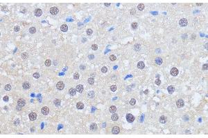 Immunohistochemistry of paraffin-embedded Rat liver using RBM39 Polyclonal Antibody at dilution of 1:100 (40x lens). (RBM39 抗体)