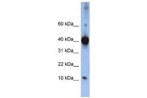 WB Suggested Anti-LSM4  Antibody Titration: 0. (LSM4 抗体  (Middle Region))