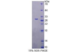 SDS-PAGE analysis of Mouse FBLN7 Protein. (FBLN7 蛋白)