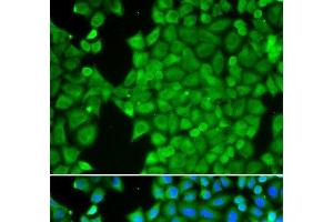 Immunofluorescence analysis of HeLa cells using CA3 Polyclonal Antibody (CA3 抗体)