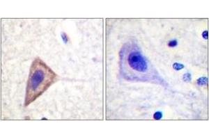 Immunohistochemistry (IHC) image for anti-Potassium Voltage-Gated Channel, Shaker-Related Subfamily, Member 3 (KCNA3) (AA 101-150) antibody (ABIN2888894)