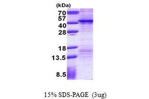 SDS-PAGE (SDS) image for Fibrinogen Silencer Binding Protein (FSBP) (AA 1-299) protein (His tag) (ABIN5853011) (FSBP Protein (AA 1-299) (His tag))