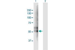 Western Blotting (WB) image for TMPRSS2 293T Cell Transient Overexpression Lysate(Denatured) (ABIN1333751)