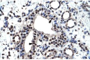 Rabbit Anti-ZNF499 Antibody Catalog Number: ARP30017 Paraffin Embedded Tissue: Human Kidney Cellular Data: Epithelial cells of collecting tubule Antibody Concentration: 4. (ZBTB45 抗体  (Middle Region))
