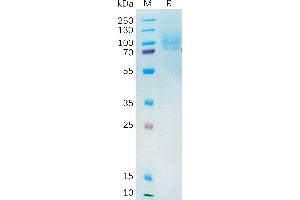 Human Protein, His Tag on SDS-PAGE under reducing condition.