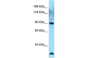 Western Blotting (WB) image for anti-EZR-ROS1 (C-Term) antibody (ABIN2789629) (EZR-ROS1 (C-Term) 抗体)