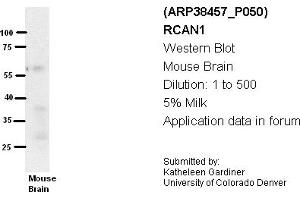 Image no. 2 for anti-Regulator of Calcineurin 1 (RCAN1) (Middle Region) antibody (ABIN405160) (RCAN1 抗体  (Middle Region))