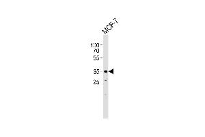 Western blot analysis of lysate from MCF-7 cell line, using FBXL17 Isoform 2 Antibody (C-term) (ABIN1944744 and ABIN2838540). (FBXL17 抗体  (C-Term, Isoform 2))