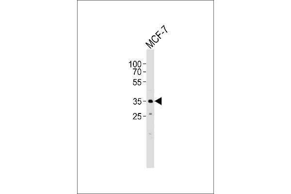 FBXL17 抗体  (C-Term, Isoform 2)