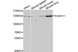 Western blot analysis of extracts of various cell lines, using FBXO11 antibody (ABIN5973628) at 1/1000 dilution. (FBXO11 抗体)