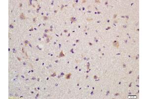 Formalin-fixed and paraffin embedded mouse brain labeled with Anti-GLUR2 Polyclonal Antibody, Unconjugated (ABIN734588) at 1:200, followed by conjugation to the secondary antibody and DAB staining (GRIA2 抗体  (AA 151-250))