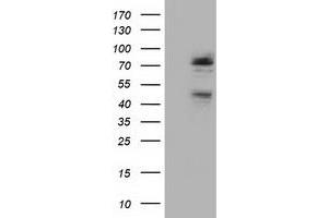 Western Blotting (WB) image for anti-NIMA (Never In Mitosis Gene A)-Related Kinase 11 (NEK11) antibody (ABIN1499683) (NEK11 抗体)