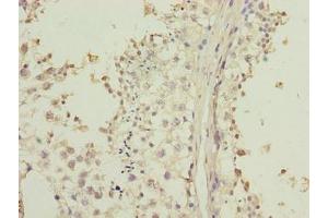 Immunohistochemistry of paraffin-embedded human testis tissue using ABIN7158154 at dilution of 1:100 (LRRC2 抗体  (AA 1-184))