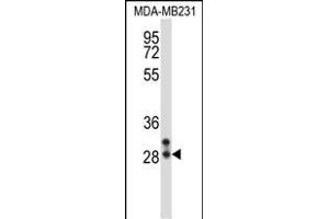NEUROG2 Antibody (Center) (ABIN657940 and ABIN2846883) western blot analysis in MDA-M cell line lysates (35 μg/lane). (Neurogenin 2 抗体  (AA 95-124))