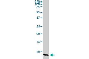 ATOX1 monoclonal antibody (M03), clone 3D10. (ATOX1 抗体  (AA 1-68))