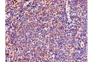 Immunohistochemistry of paraffin-embedded human lymph node tissue using ABIN7151053 at dilution of 1:100 (LNX1 抗体  (AA 133-259))