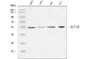 Western blot analysis of KLF10 using anti-KLF10 antibody (ABIN7601477).