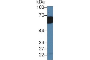 Western Blot; Sample: Mouse Serum; Primary Ab: 2µg/ml Rabbit Anti-Mouse IL18RAP Antibody Second Ab: 0. (IL18RAP 抗体  (AA 396-548))