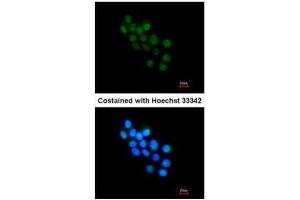 ICC/IF Image Immunofluorescence analysis of paraformaldehyde-fixed HepG2, using FOXB1, antibody at 1:200 dilution. (FOXB1 抗体  (C-Term))