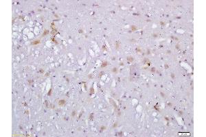 Formalin-fixed and paraffin embedded rat brain labeled with Anti-RLBP1L1 Polyclonal Antibody, Unconjugated  followed by conjugation to the secondary antibody and DAB staining (Clavesin 1 抗体  (AA 231-330))