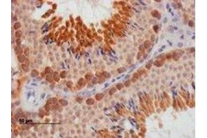 Immunohistochemistry (IHC) image for anti-Deleted in Azoospermia-Like (DAZL) (Internal Region) antibody (ABIN2465585) (DAZL 抗体  (Internal Region))